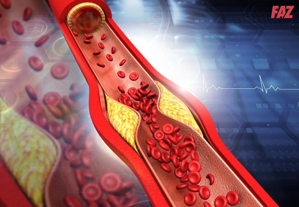 Cholesterol luôn có hại cho cơ thể?