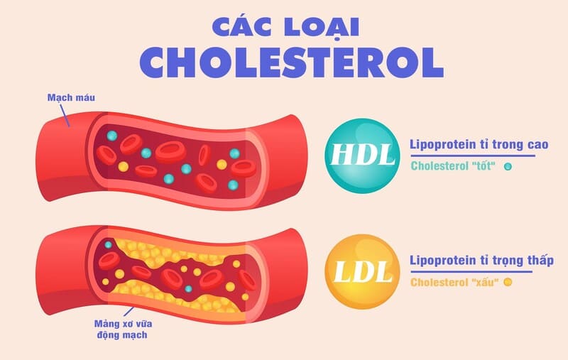 phân loại cholesterol