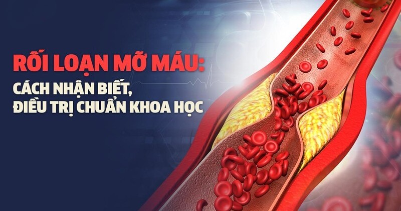 Rối loạn mỡ máu: Nguyên nhân do đâu, điều trị thế nào mới hiệu quả?