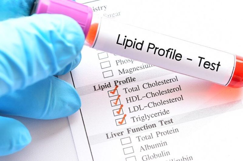 thông số điều trị rối loạn lipid máu