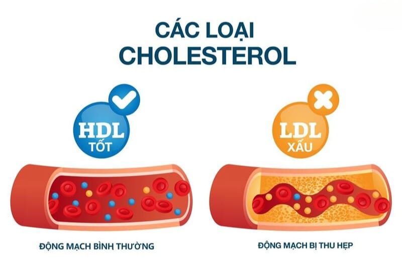cholesterol hdl và ldl