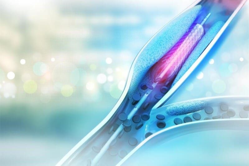 5 cách điều trị bệnh tim mạch an toàn, hiệu quả đúng khoa học