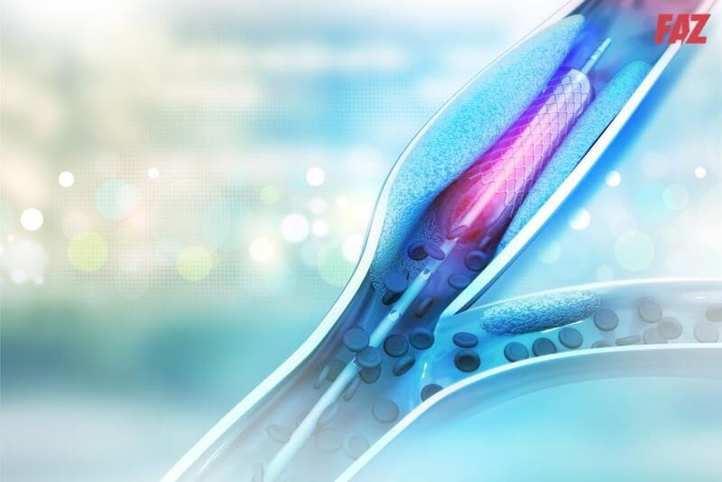 5 cách điều trị bệnh tim mạch an toàn, hiệu quả đúng khoa học