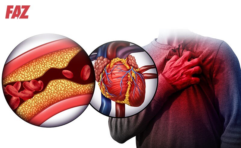3 cách điều trị rối loạn lipid máu và phòng ngừa hiệu quả