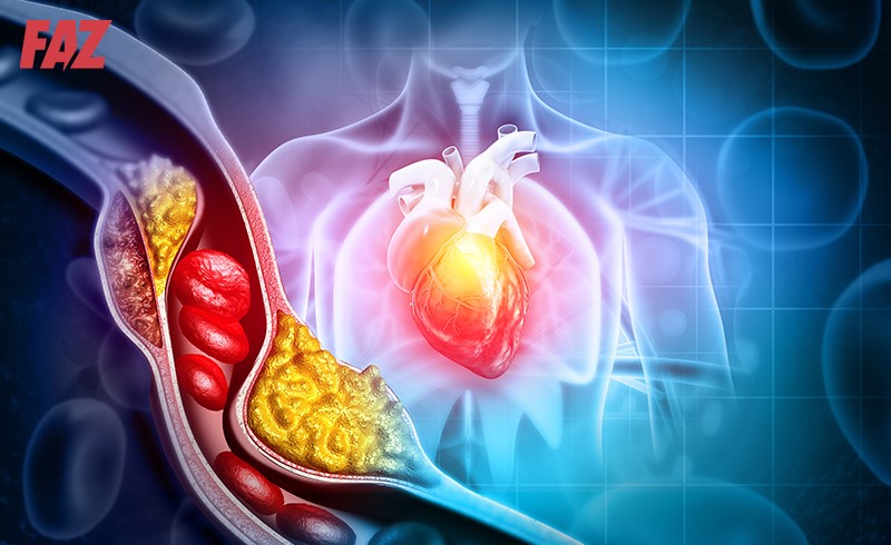 15 triệu chứng rối loạn lipid máu (mỡ máu) thường gặp