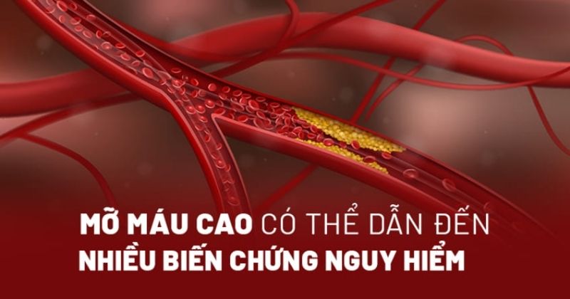 mỡ máu cao