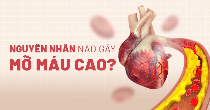 nguyên nhân gây mỡ máu cao