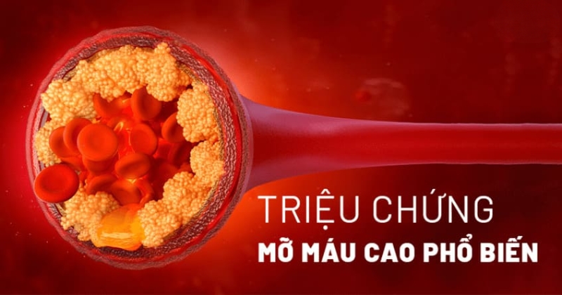 3 triệu chứng mỡ máu cao biểu hiện bên ngoài rất dễ nhận biết