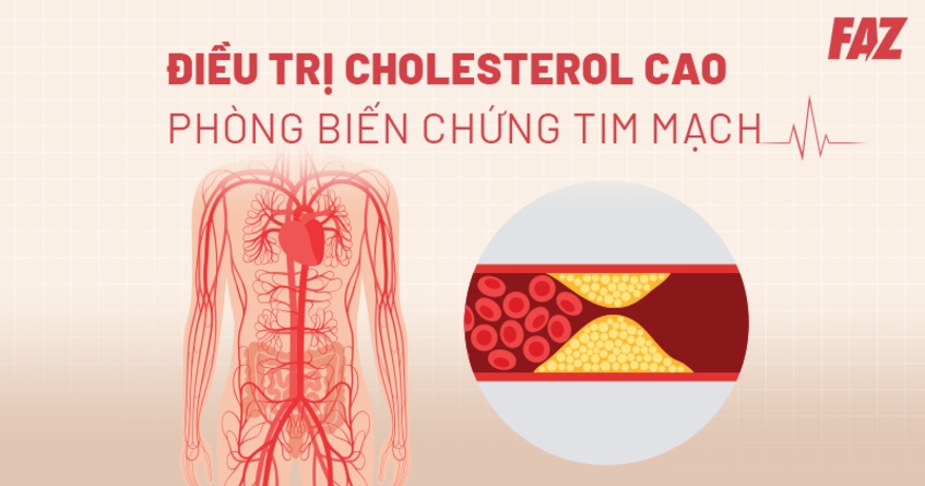 điều trị cholesterol cao