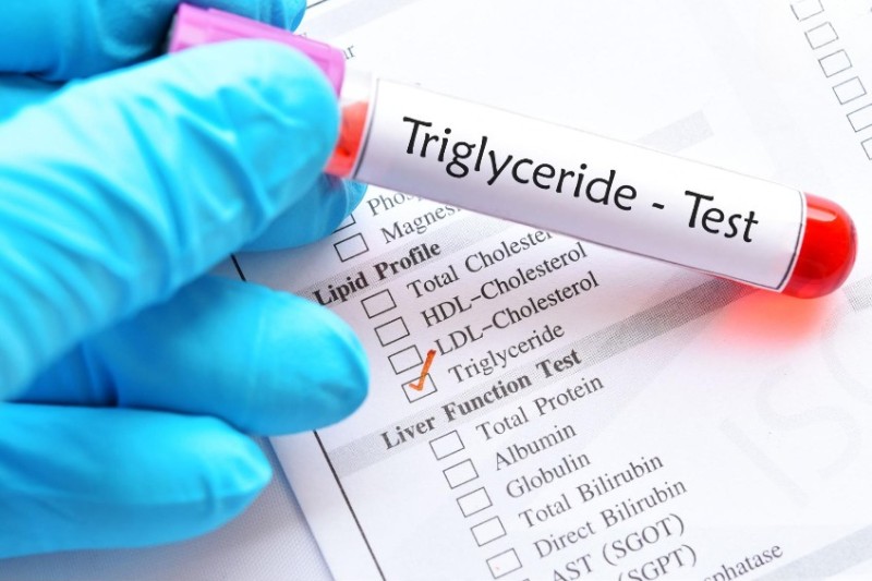 test chỉ số triglyceride
