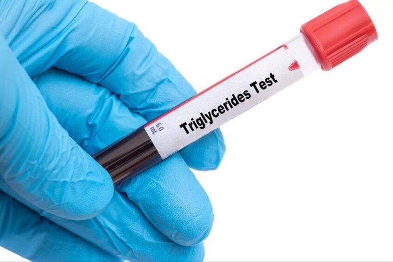 xét nghiệm triglyceride theo bác sĩ