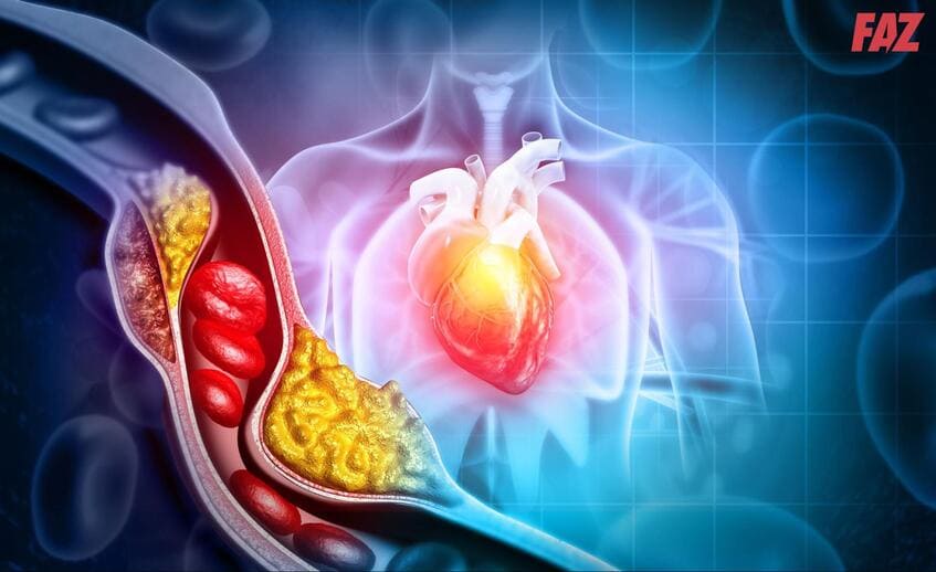 cholesterol và triglyceride là hai thành phần mỡ máu