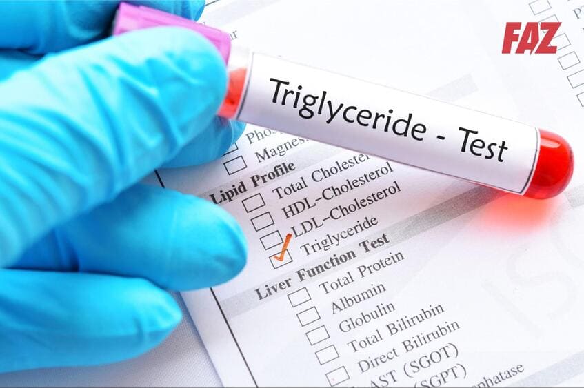 xét nghiệm máu giúp đo chỉ số Triglyceride