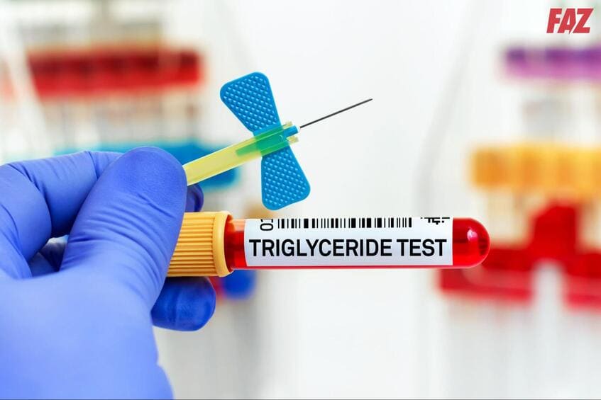 Xét nghiệm triglyceride giúp xác định nguy cơ bệnh tim