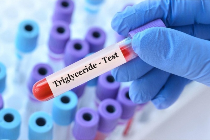 chẩn đoán tăng triglyceride mau