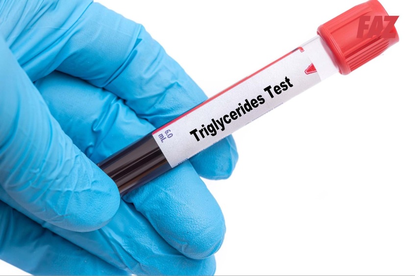 điều trị tăng triglycerid đơn thuần