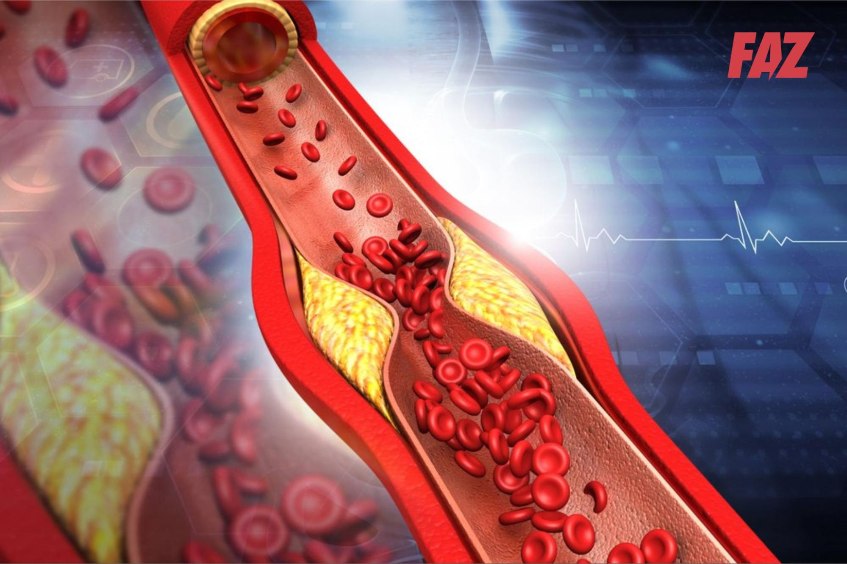 điều trị triglyceride máu đơn thuần