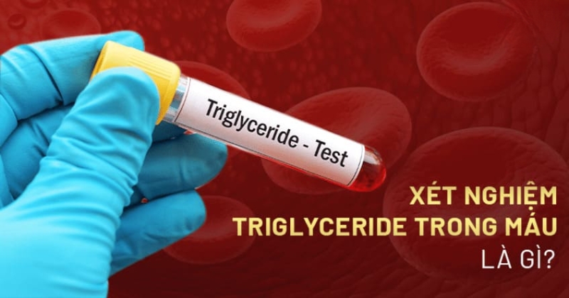 xét nghiệm triglyceride máu