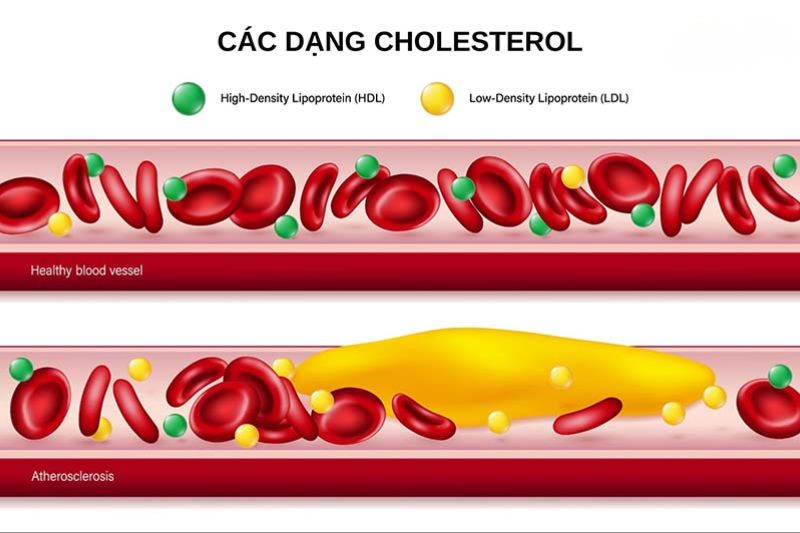 cholesterol là một thành phần của mỡ máu