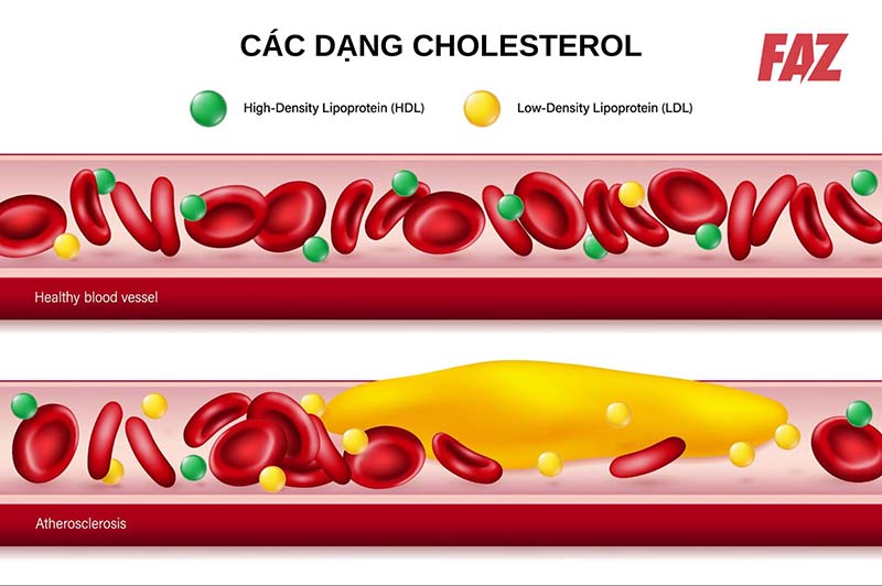 cholesterol là một thành phần của mỡ máu