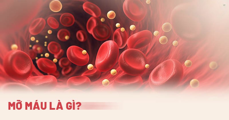 mỡ máu là gì