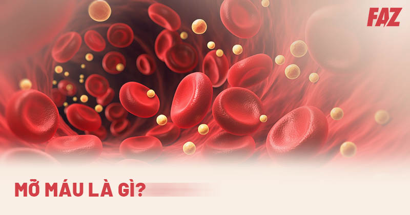 Mỡ máu là gì? Các bệnh liên quan đến mỡ trong máu