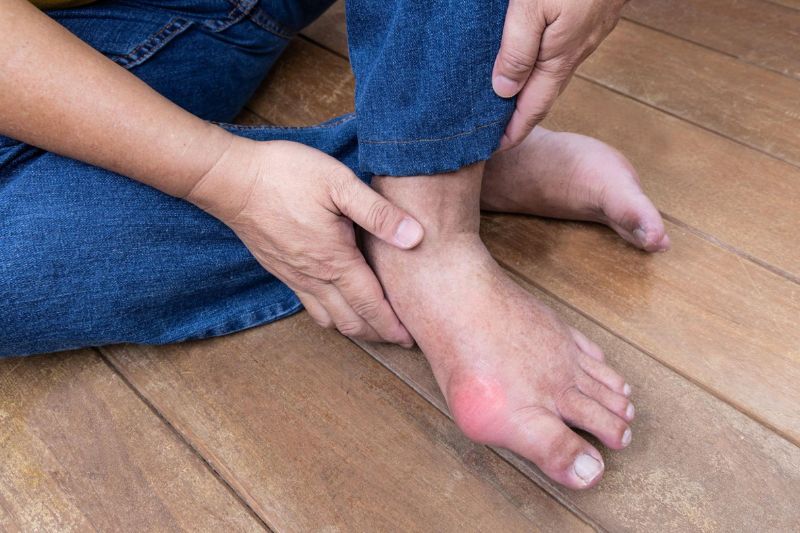 bị gout kèm mỡ máu nên hạn chế dùng hải sản