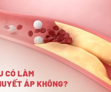 Giải đáp: Mỡ máu có làm tăng huyết áp không?