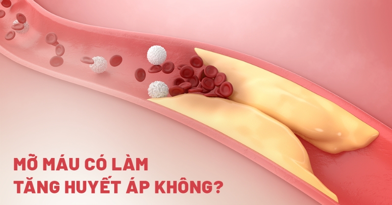 Giải đáp: Mỡ máu có làm tăng huyết áp không?
