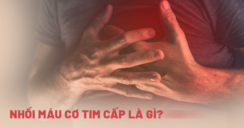 Hiểu về tình trạng nhồi máu cơ tim cấp sao cho đúng?