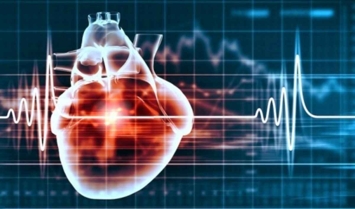 tim bị rối loạn nhịp