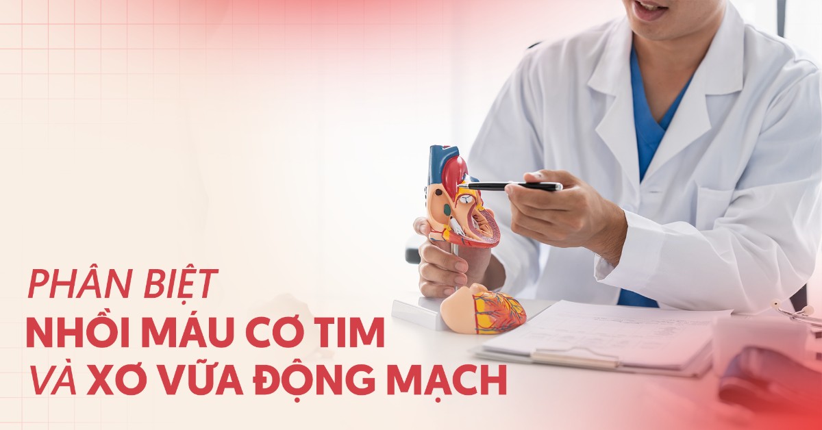 Mối quan hệ giữa nhồi máu cơ tim và xơ vữa động mạch là gì?